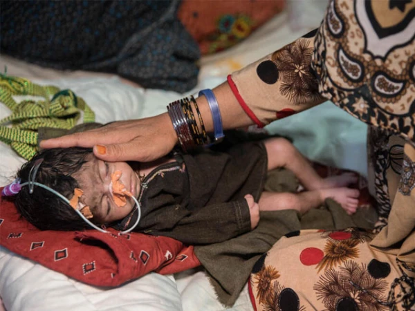 افغانستان میں غذائی قلت کی بدترین لہر، 10 ملین افراد شدید بحران کا شکار