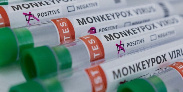 پاکستان میں منکی پاکس کا نیا کیس رپورٹ، محکمہ صحت کا ہائی الرٹ