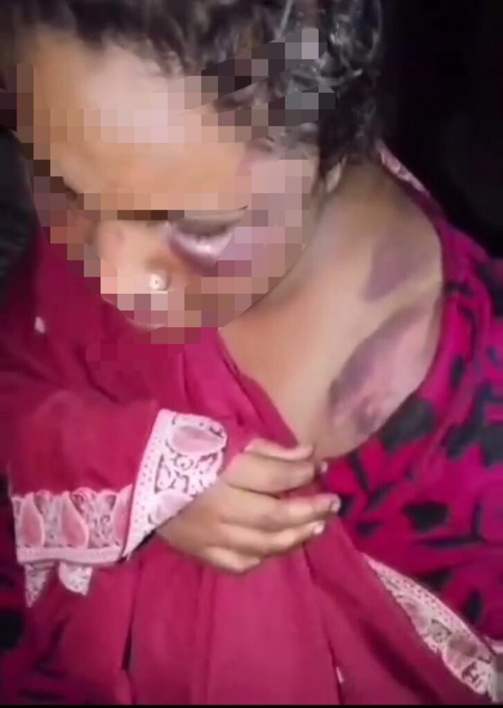 گوجرانولہ کے تھانہ اروپ میں خاوند کا اپنی بیوی پر بیہمانہ تشدد