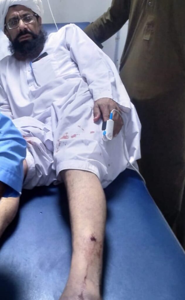 ہسپتال کے سامنے نامعلوم افراد نے دستی بم پھینک کرکے فرار چار افراد زخمی