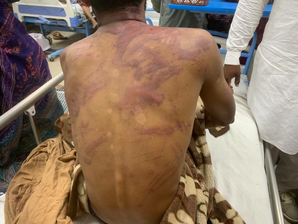 لڑکیوں کو چھیڑنے سے منع کرنے پر شہری پر وحشیانہ تشدد