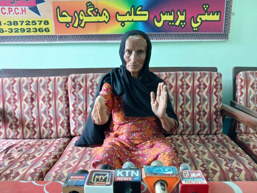 ہنگورجا: زرعی زمین کی رقم میں فراڈ اور دھمکیوں کے خلاف معذور بیوہ خاتون پریس کلب پہنچ گئی، انصاف کا مطالبہ